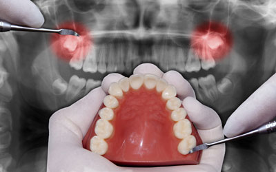 Oral & Maxiliofacial Surgery Department